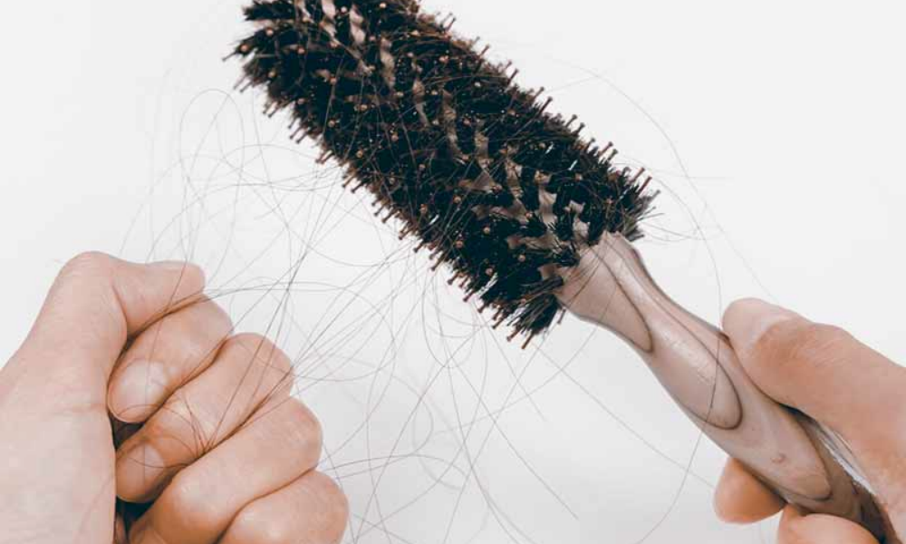 5 solutions against hair loss