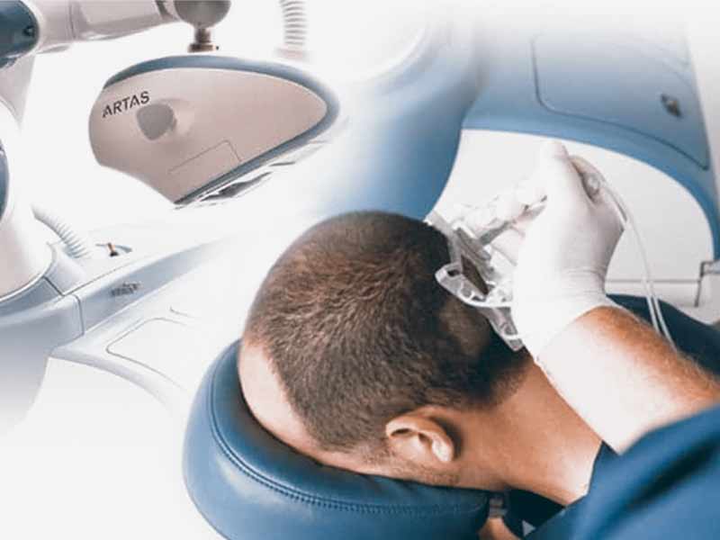ARTAS Technology: Robotic Hair Transplantation