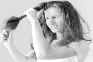 uncombable hair syndrome-1