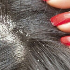 most common hair problems
